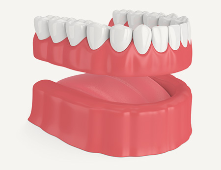 Removable Denture